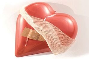 Osteochondrosis ของกระดูกสันหลังทรวงอกส่งผลเสียต่อหัวใจ